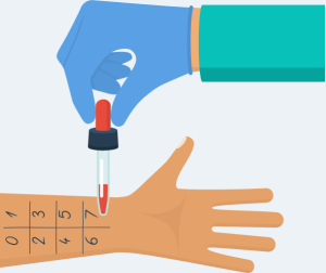 Skin Prick Testing