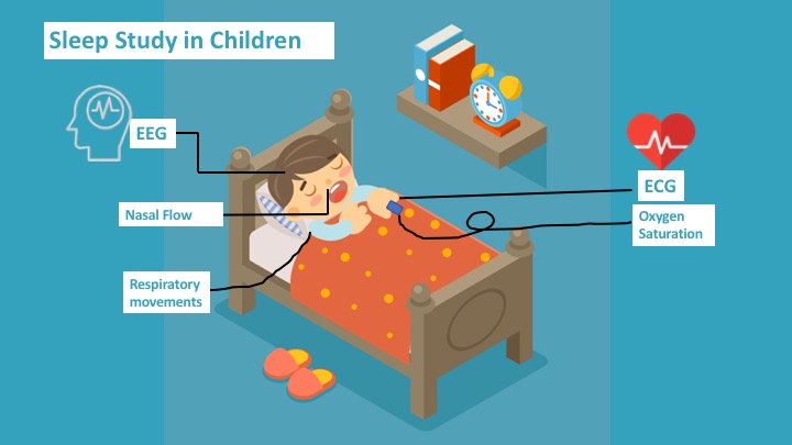 What is a sleep study?