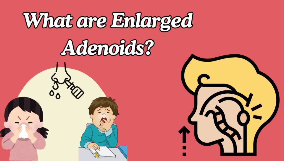 Enlarged Adenoids