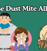 House Dust Mite Allergy in Children House Dust Mite Allergy in Children