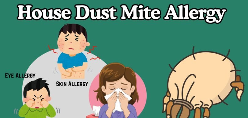 House Dust Mite Allergy in Children