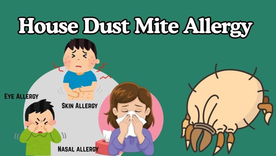 House Dust Mite Allergy in Children House Dust Mite Allergy in Children