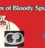 Hemoptysis: Blood in Sputum in Children