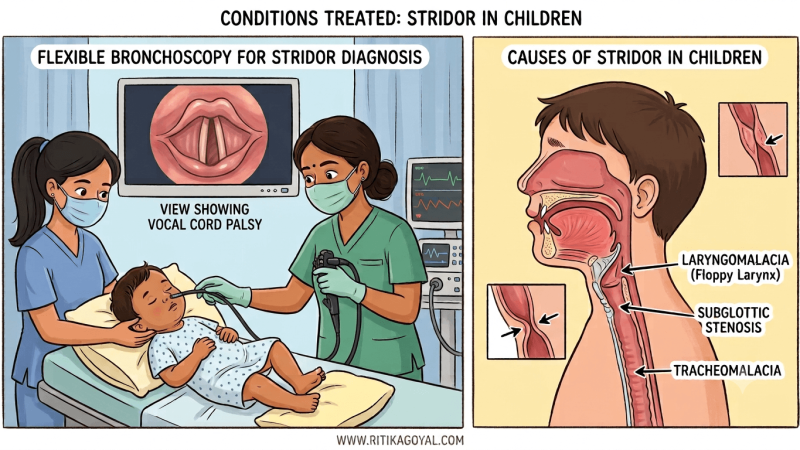 Stridor in Children